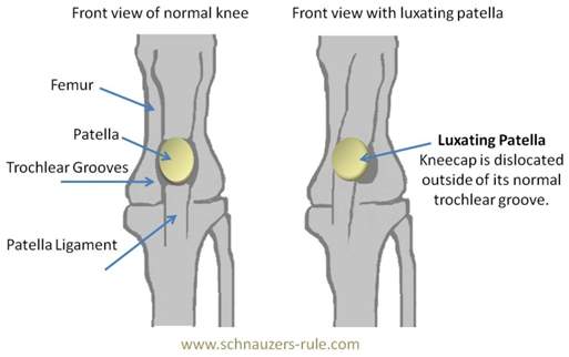 A picture of the front view and side view of a knee.